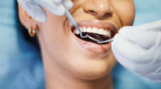Best Emergency Dental Care for Broken or Chipped Teeth in Hailey, ID
